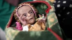 Newborn Twins Cling to Life in Yemen as Escalating Conflict Deepens Nationwide Famine