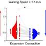 Backward motion is easier to judge at walking speed